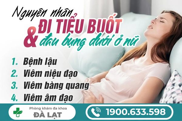 Hình ảnh minh họa